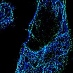 Combination Of High Resolution Afm With Super Resolution Stochastic Optical Reconstruction Microscopy Storm