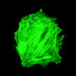 Combined Fluorescence And Afm Imaging Of Cells