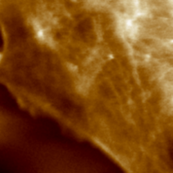 The Application Of Nano Wizard Ultra Speed Afm