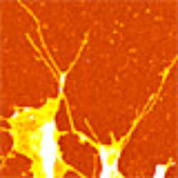 Tracking Cells Footprints Modern Microscopy Methods Visualize Bio Nanotubes