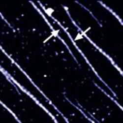 Collagen Manipulation