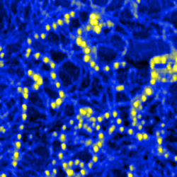 Height Image Zoom 1Μm