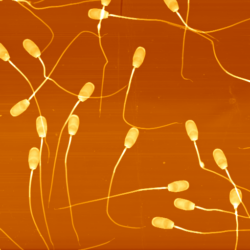 Sperm 2008 01 13 15 15 12 Height Tracea