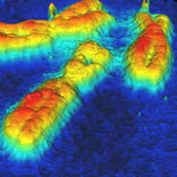 Human Lymphocyte Chromosomes Thumbnail