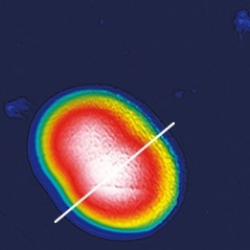 Living Cyanobacterium Thumbnail