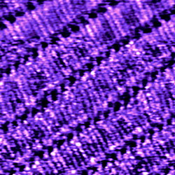 Scanning Tunneling Microscopy 1
